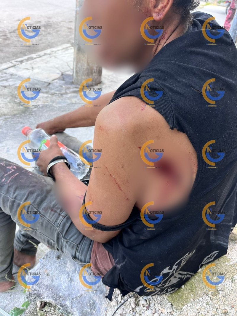 Hombre lesionado en Av. Francisco I Madero