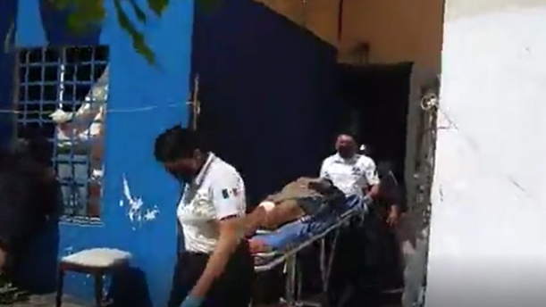 Ladrones roban una moto y hieren de un tiro a una mujer
